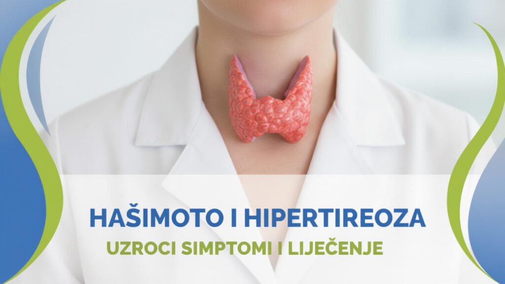 Hašimoto hipertireoza simptomi uzroci liječenje