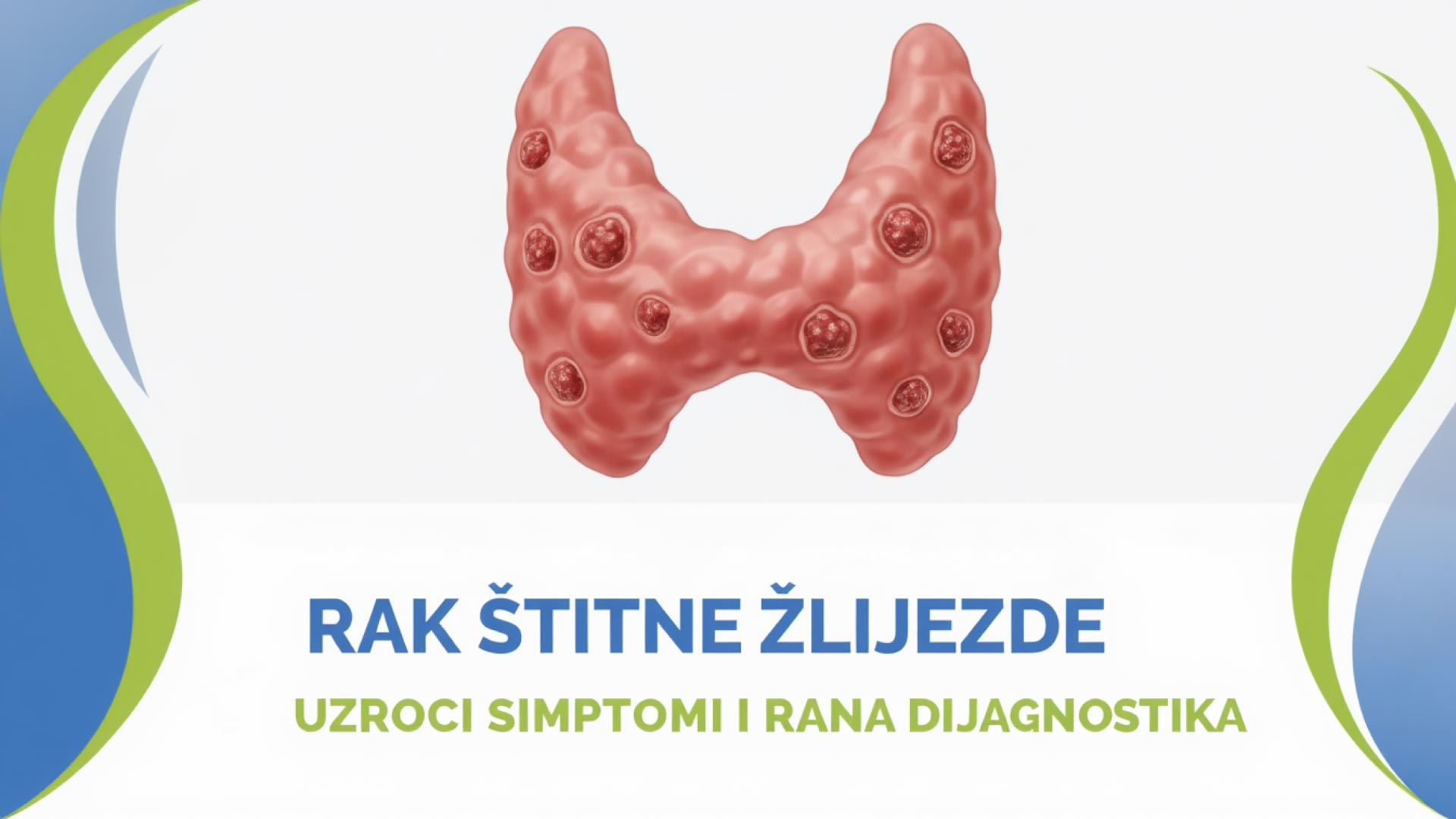 Rak štitne žlijezde simptomi uzroci rana dijagnostika