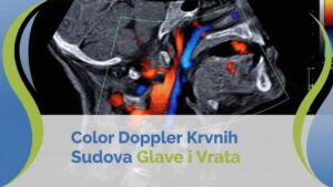 kolor dopler krvnih sudova vrata glave