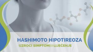 Hipotireoza simptomi uzroci liječenje