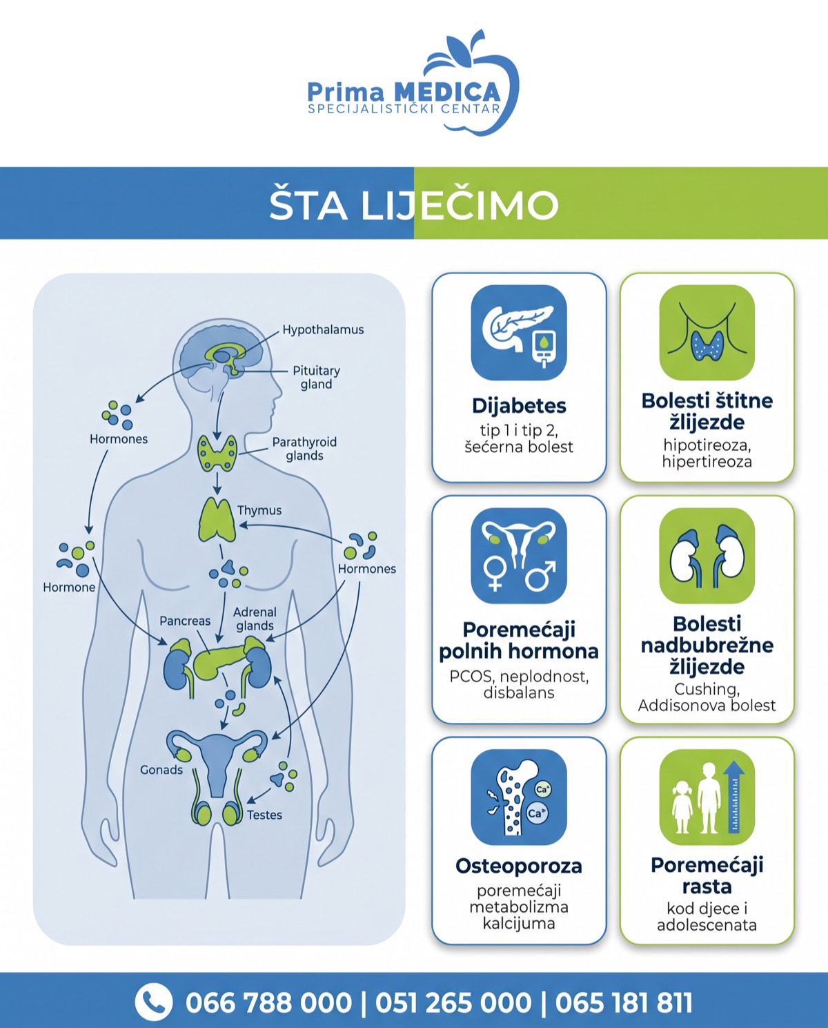 Šta liječi endokrinolog - Prima MEDICA Banja Luka