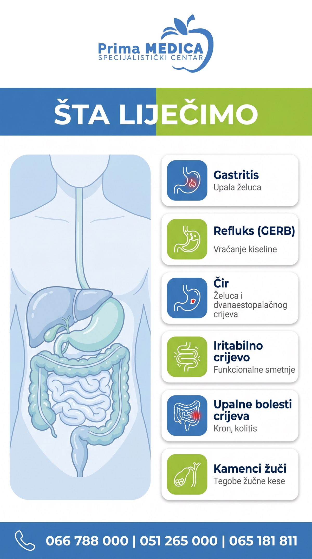 Šta liječi gastroenterolog - gastritis, refluks, čir - Prima MEDICA Banja Luka