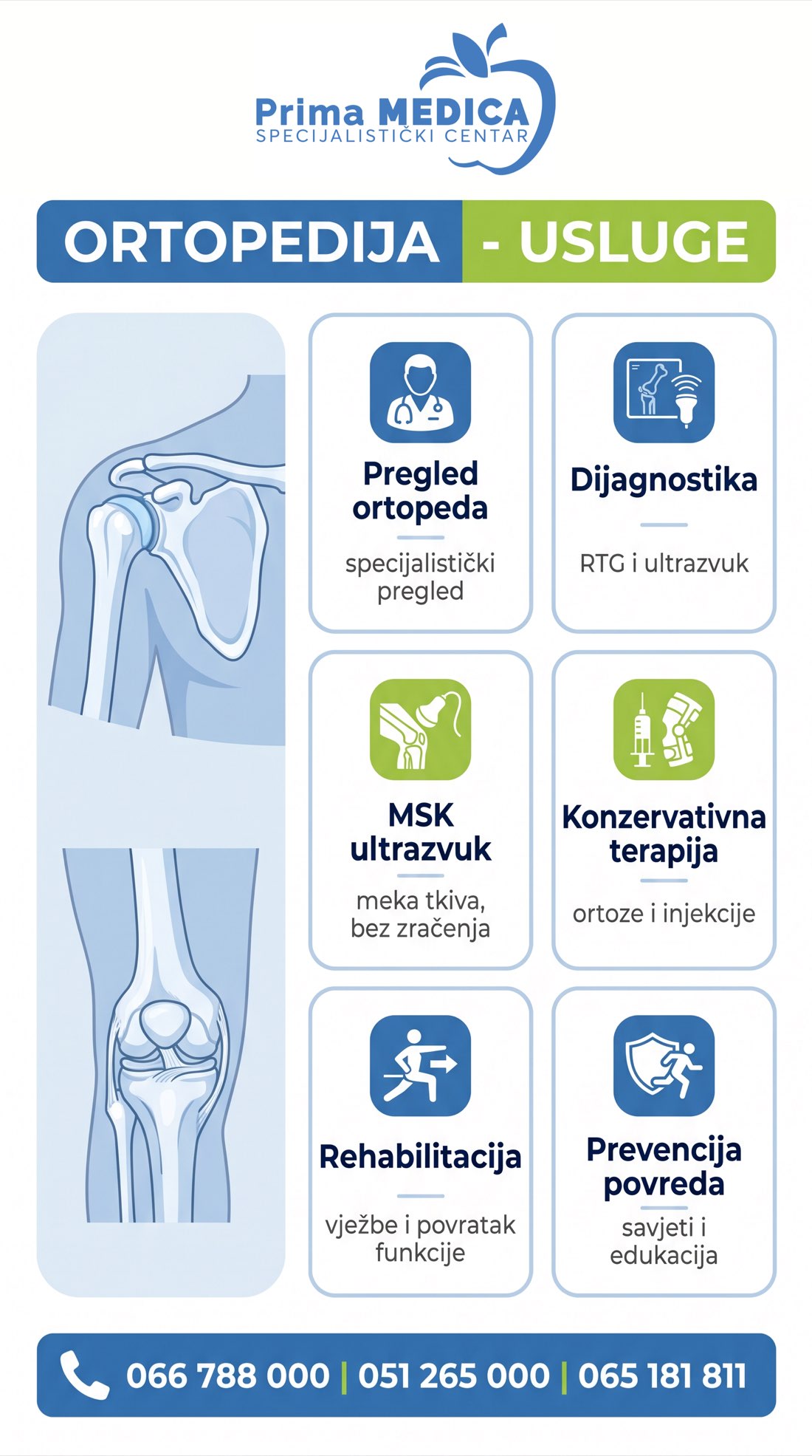 Ortopedija Prima MEDICA - usluge ambulante ortopedije