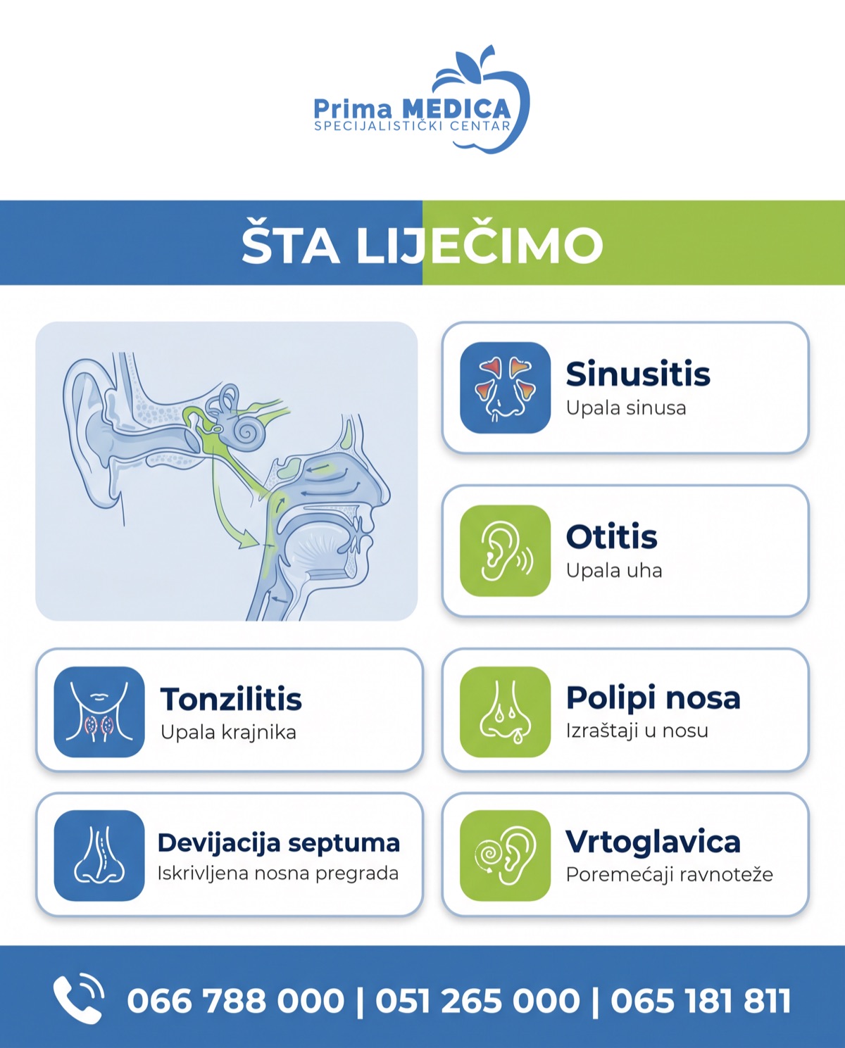 Šta liječi ORL - sinusitis, otitis, tonzilitis, polipi - Prima MEDICA Banja Luka