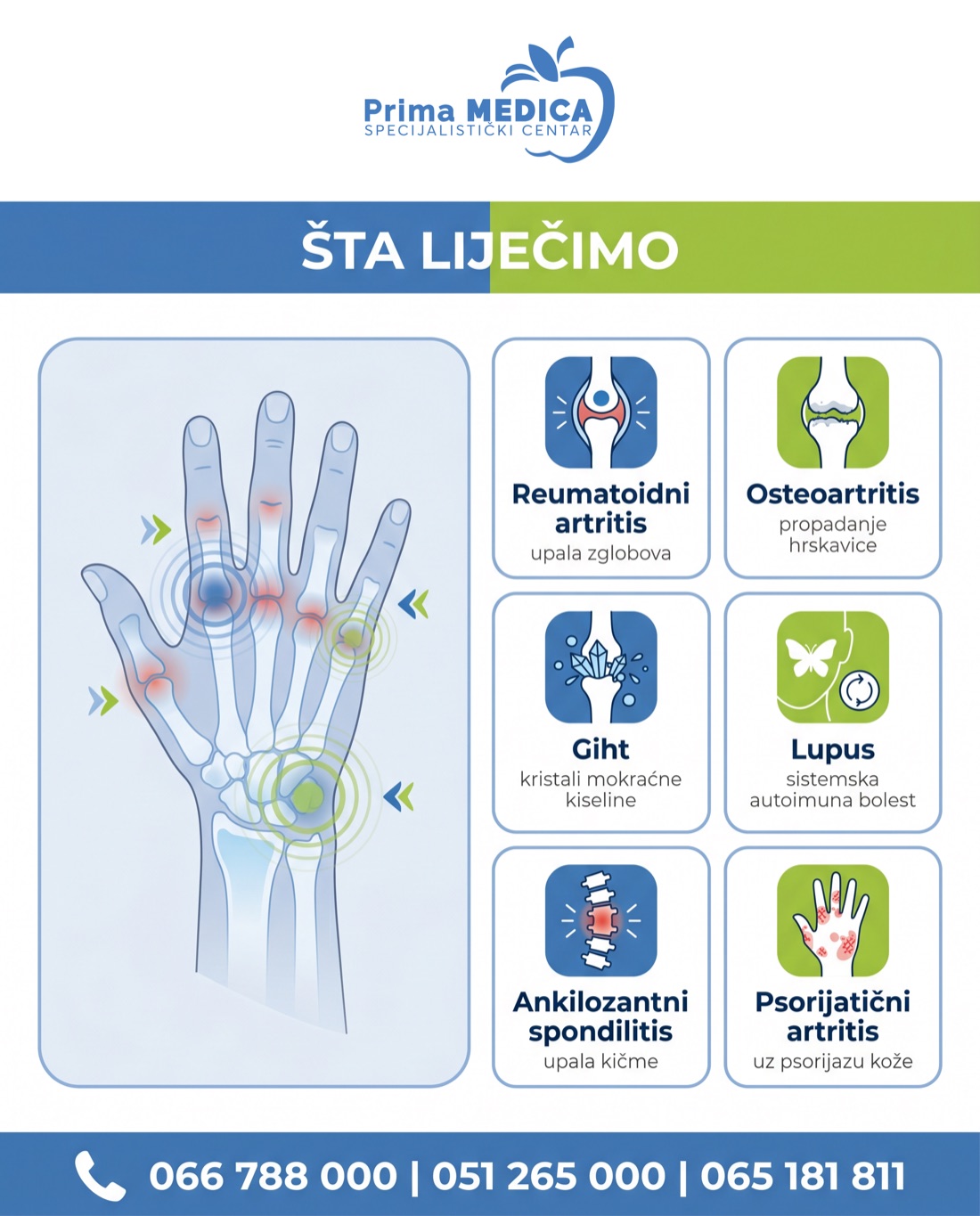 Reumatske bolesti koje liječimo - Prima MEDICA Banja Luka