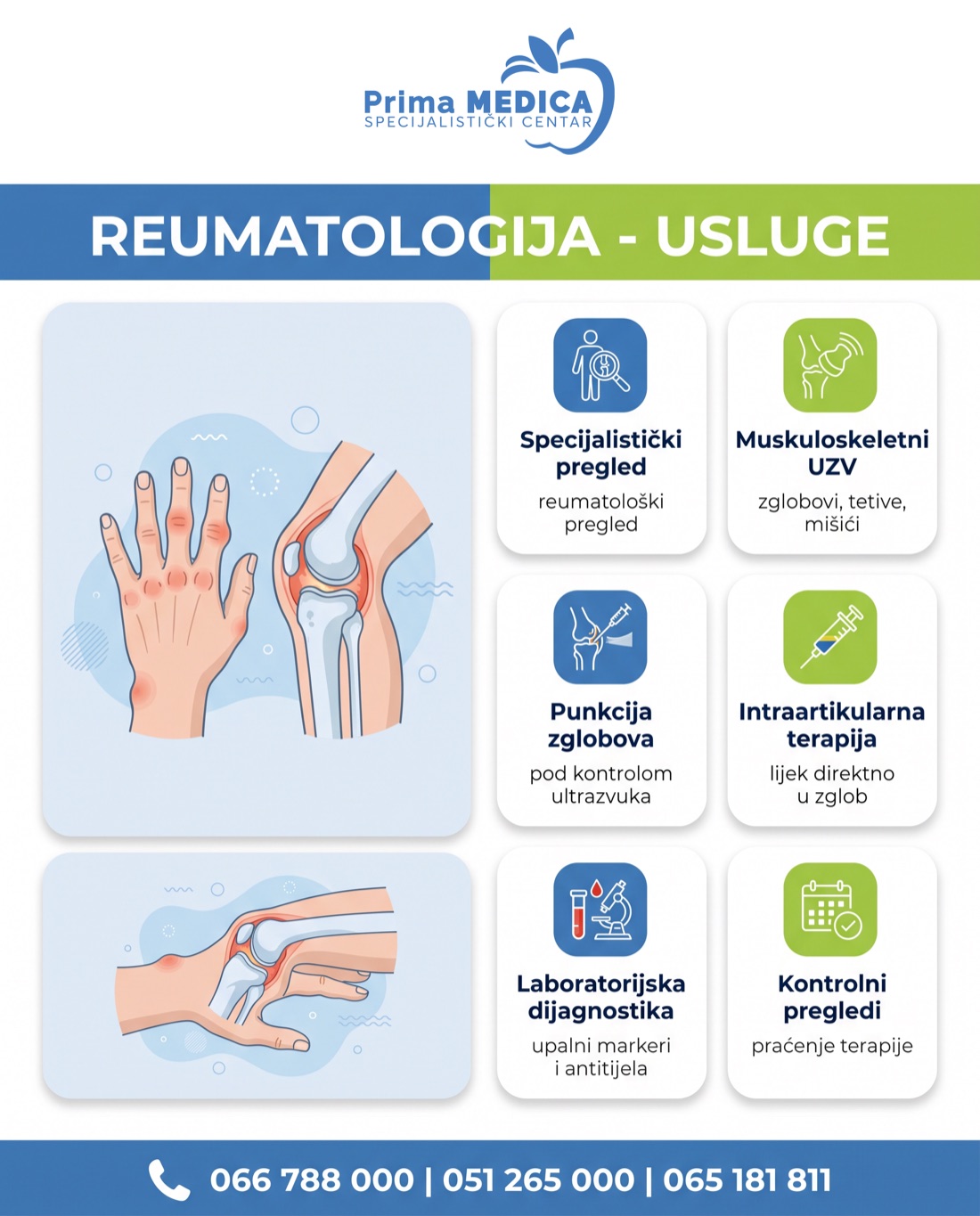 Reumatologija usluge - Prima MEDICA Banja Luka