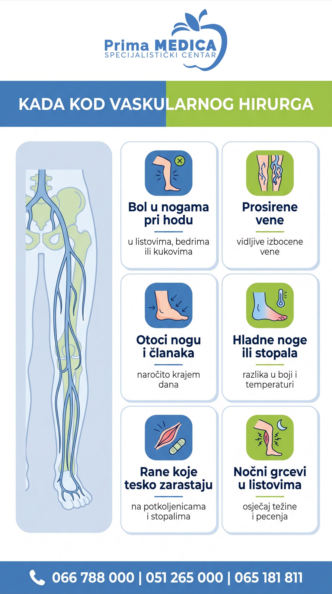 Kada kod vaskularnog hirurga - simptomi i indikacije