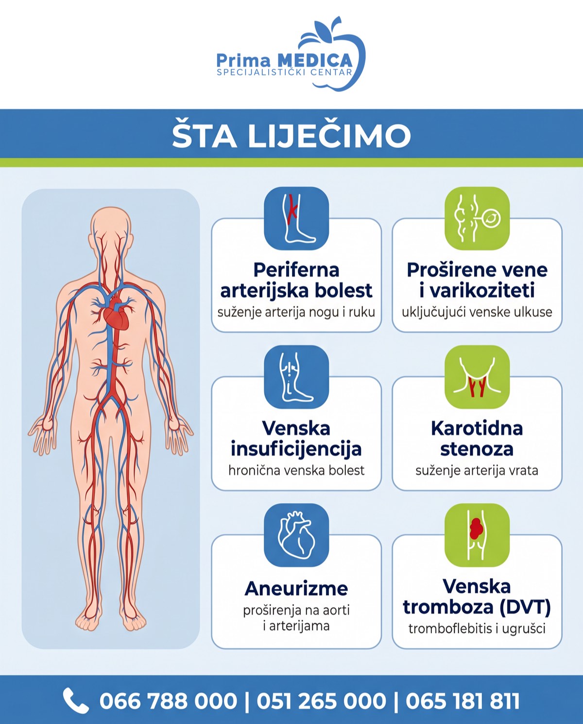 Sta lijecimo - vaskularna oboljenja Prima MEDICA
