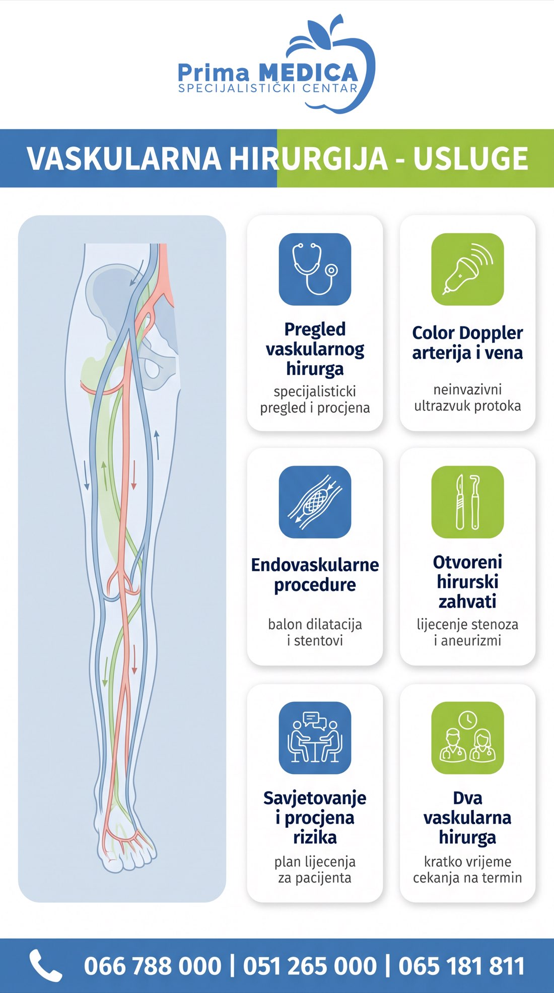 Vaskularna hirurgija Prima MEDICA - usluge ambulante