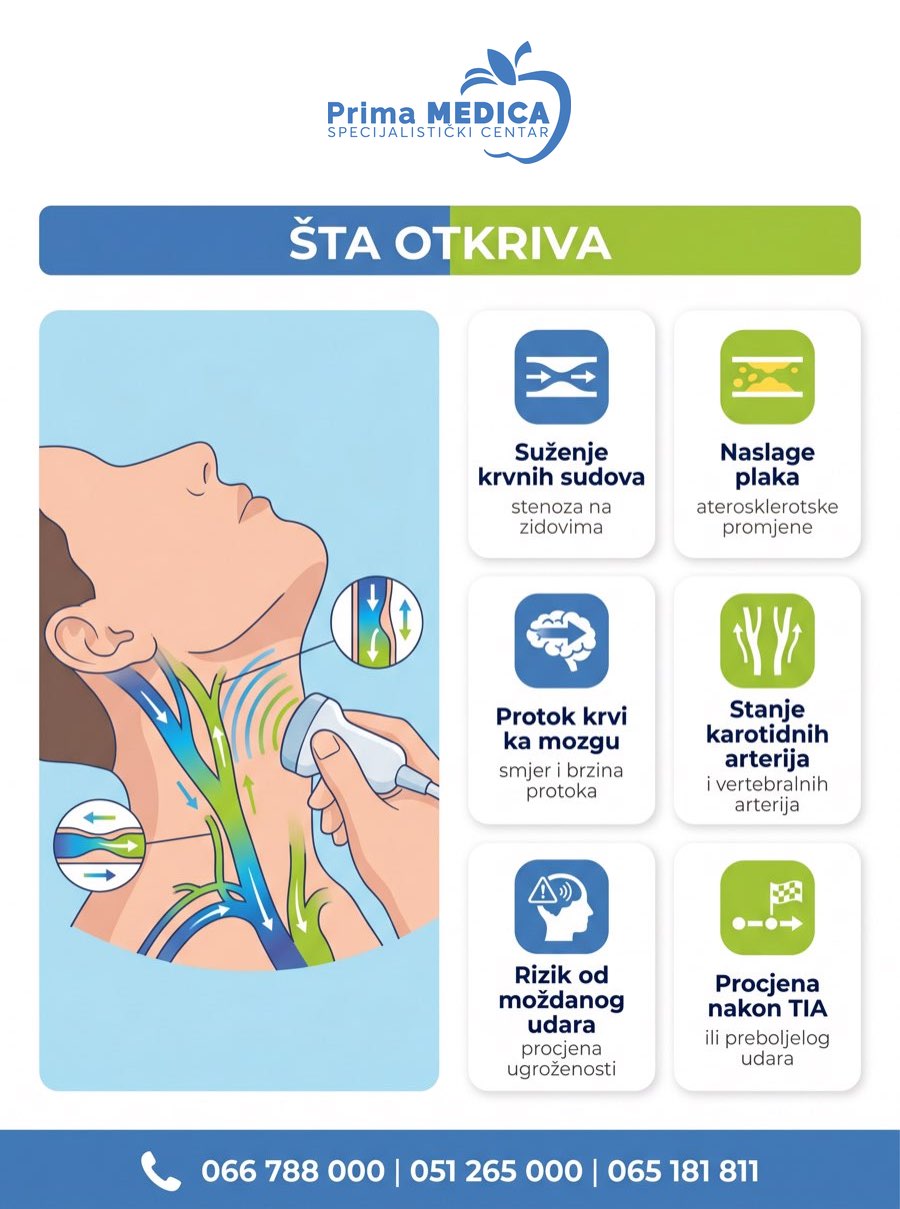 Sta otkriva kolor dopler krvnih sudova vrata i glave - stenoza, plak, protok krvi, Prima MEDICA Banja Luka