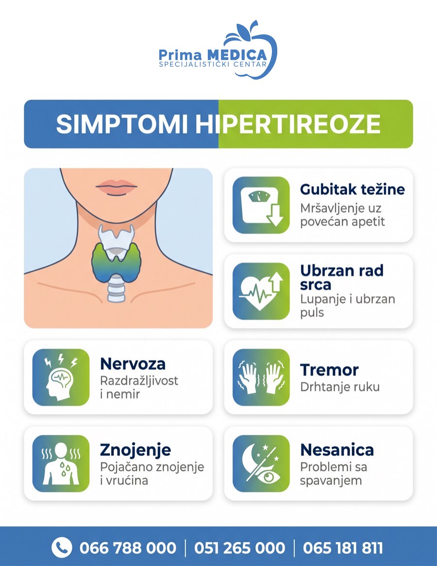 Simptomi hipertireoze - ubrzan rad štitne žlijezde, Prima MEDICA Banja Luka