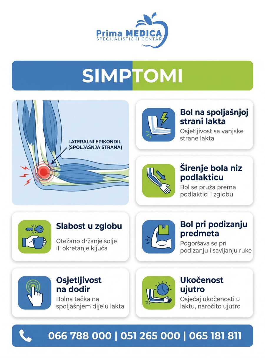 Simptomi teniskog lakta (lateralni epikondilitis) - infografika Prima MEDICA