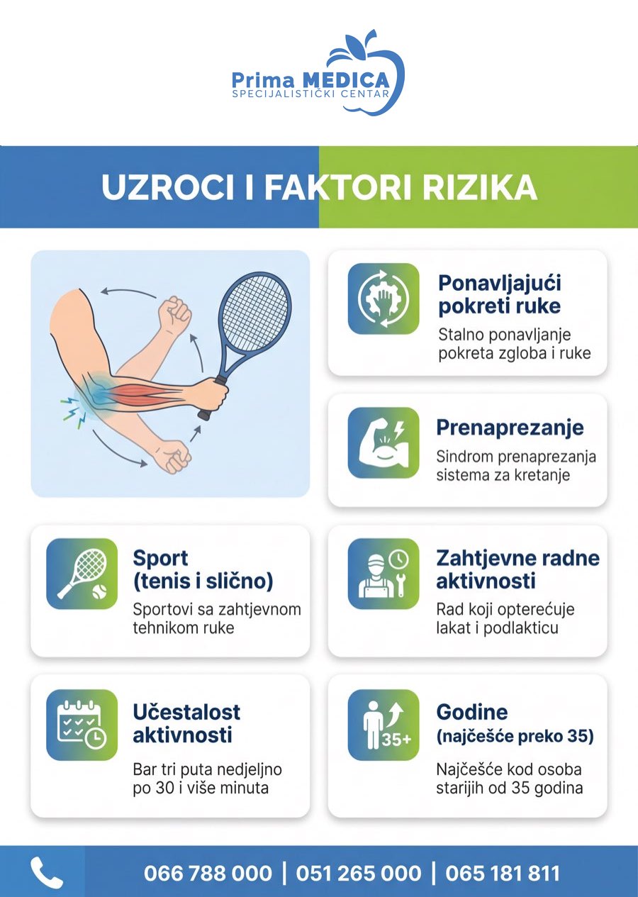 Uzroci i faktori rizika za teniski lakat - infografika Prima MEDICA