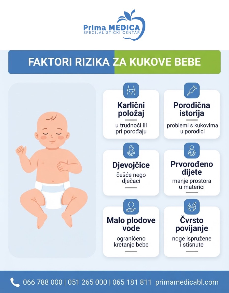 Faktori rizika za razvojni poremećaj kuka kod beba